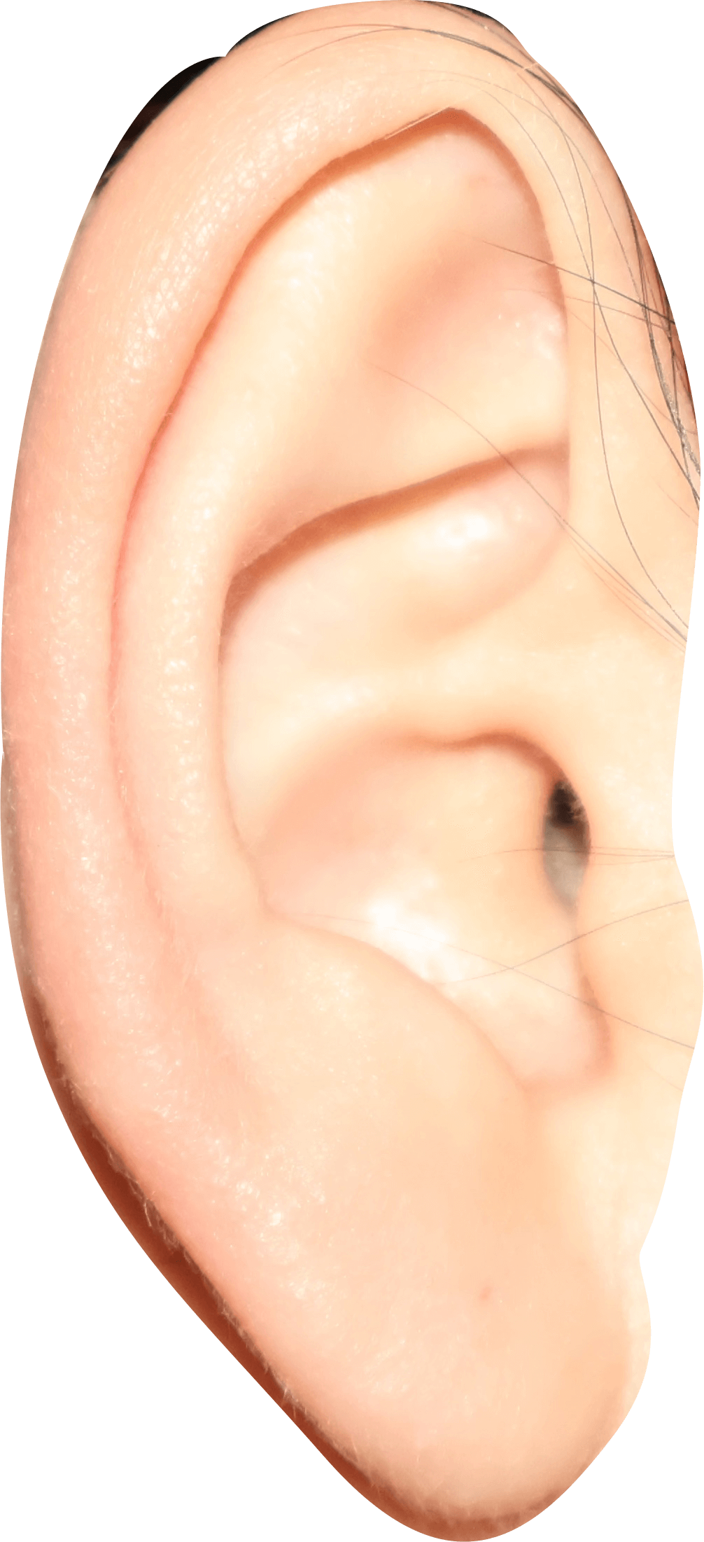 Ear 1